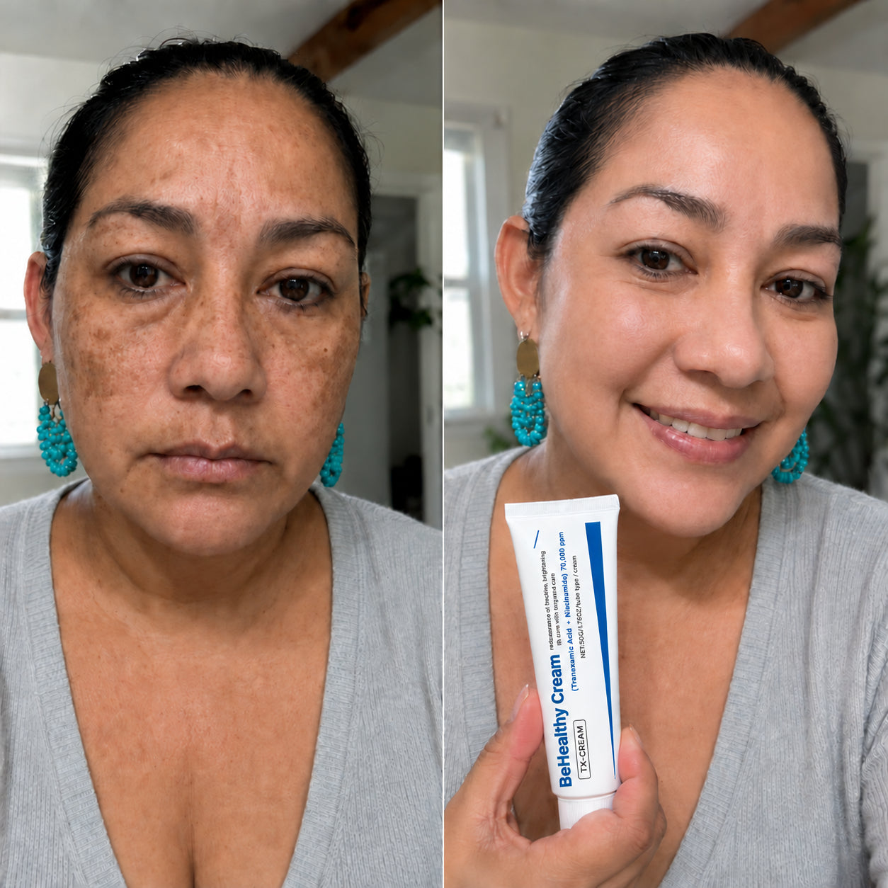 BeHealthy Cream — corrector de manchas