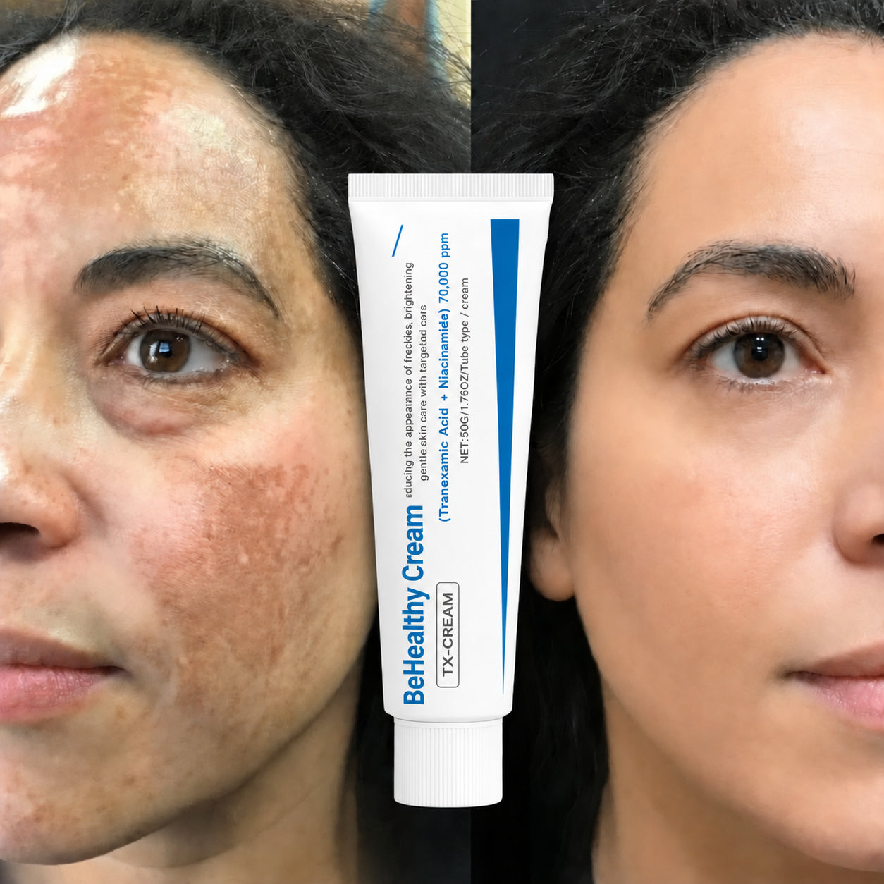 BeHealthy Cream® Corrector de Manchas