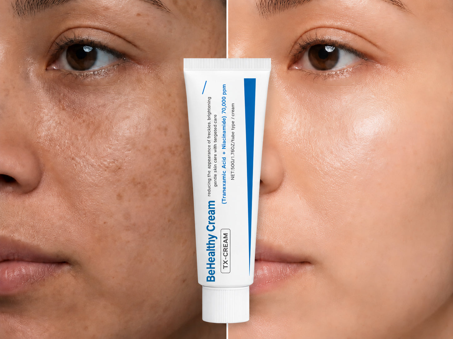 BeHealthy Cream — corrector de manchas