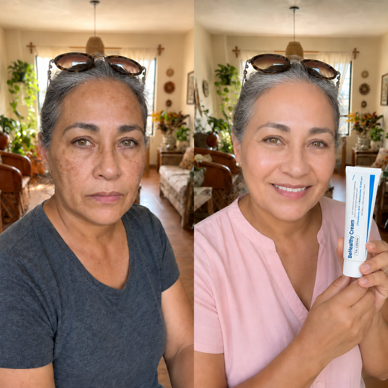 BeHealthy Cream — corrector de manchas