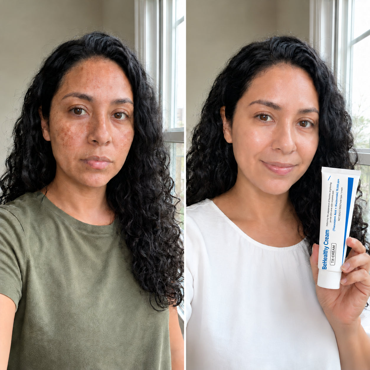 BeHealthy Cream — corrector de manchas