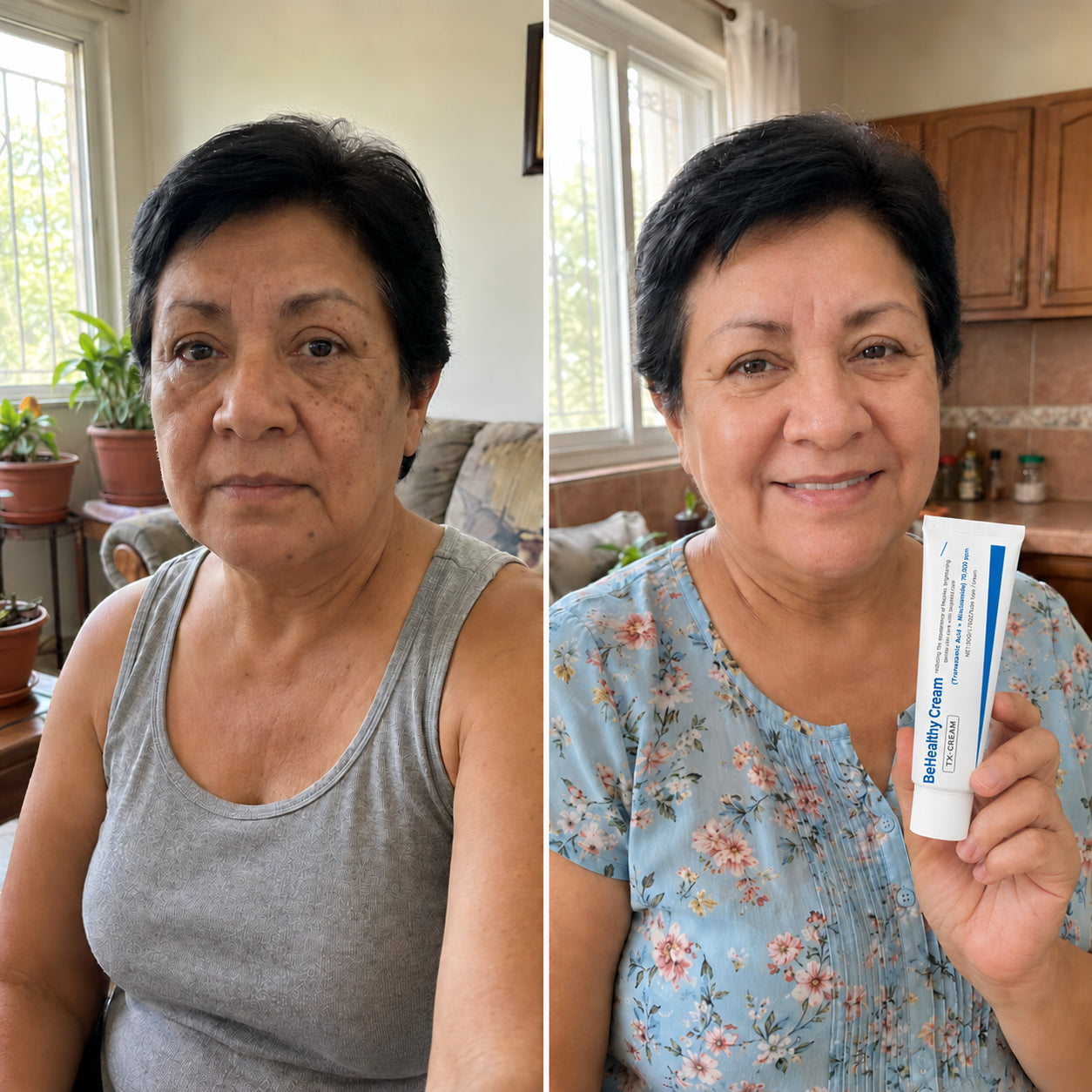 BeHealthy Cream — corrector de manchas